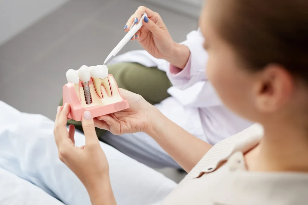 Dental Implant Procedure Explanation Model