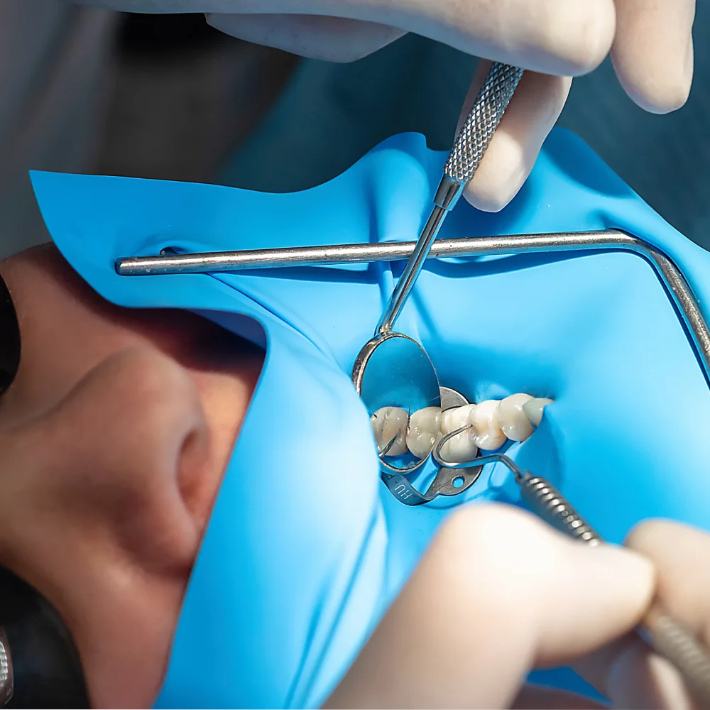 Dental Treatment with Rubber Dam Isolation