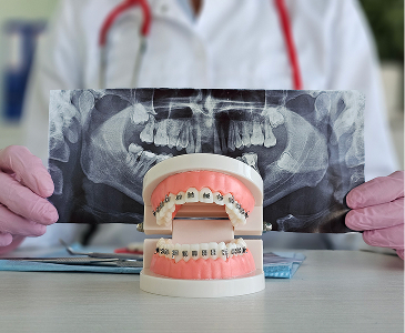 Orthodontic X-Ray and Braces Consultation