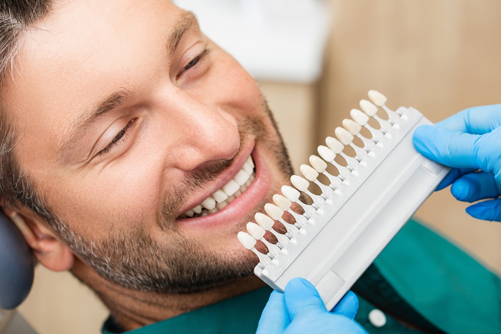 Teeth Shade Matching for Dental Veneers